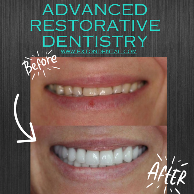 Images Exton Dental Health Group