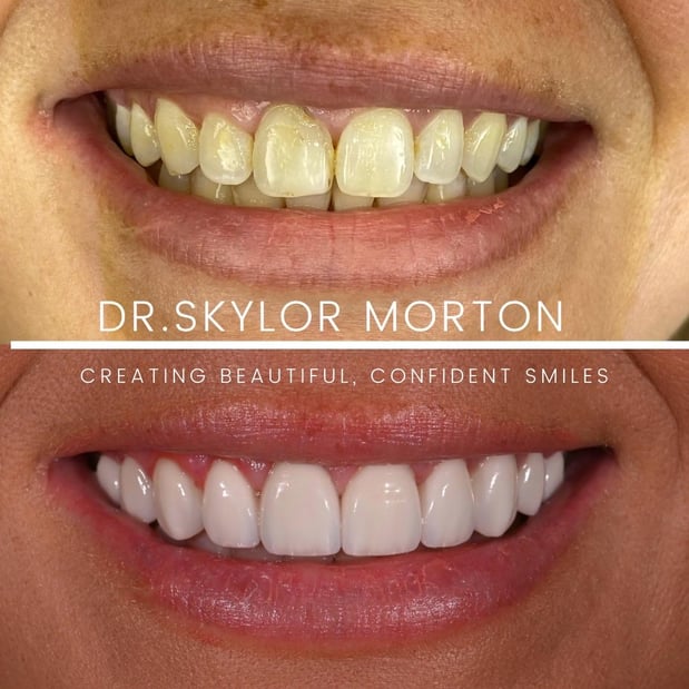 Images Nashville Wisdom Teeth and Implant Solutions