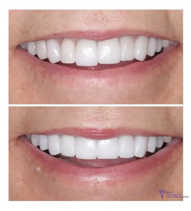 Images Mary Elizabeth Viechnicki, DMD