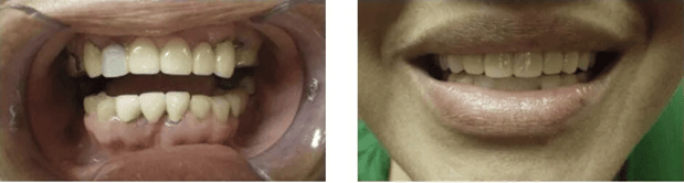 Images Allen Dentistry
