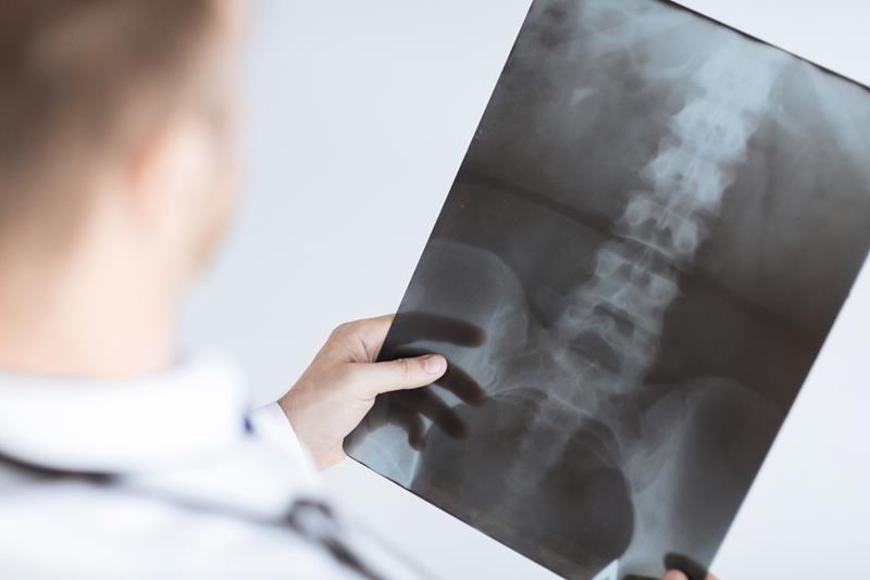 With digital and high-frequency equipment, we can take the highest quality radiographs with the lowest exposure to our patients.

One of the most important elements of chiropractic care is diagnostics. Chiropractic radiology is a tool utilized in care as a diagnostic practice to rule out pathology (such as possible tumor or fracture) and/or an additional aid to determine where to adjust the spine. Chiropractors rely on a variety of diagnostic techniques in order to fully understand what is occurring in the patient’s musculoskeletal system, and how a given treatment intervention could bring about positive results in each patient.