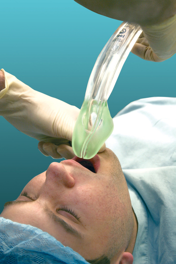 Images Intersurgical