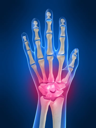 Images Orthopedic Hand Surgeon - Dr. Jeffrey E. Budoff, MD