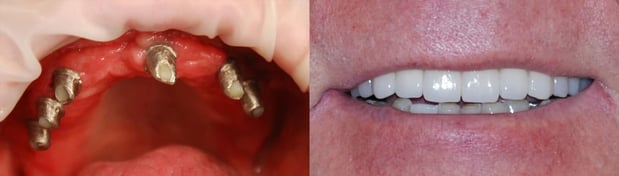 Images Today's Dental Care