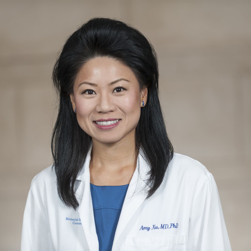 Amy Xu, MD, PhD - MSK Radiation Oncologist