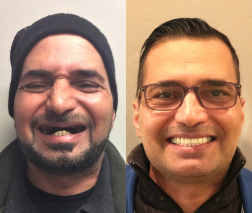 Before and After from Stubbs Dental | Murray, UT