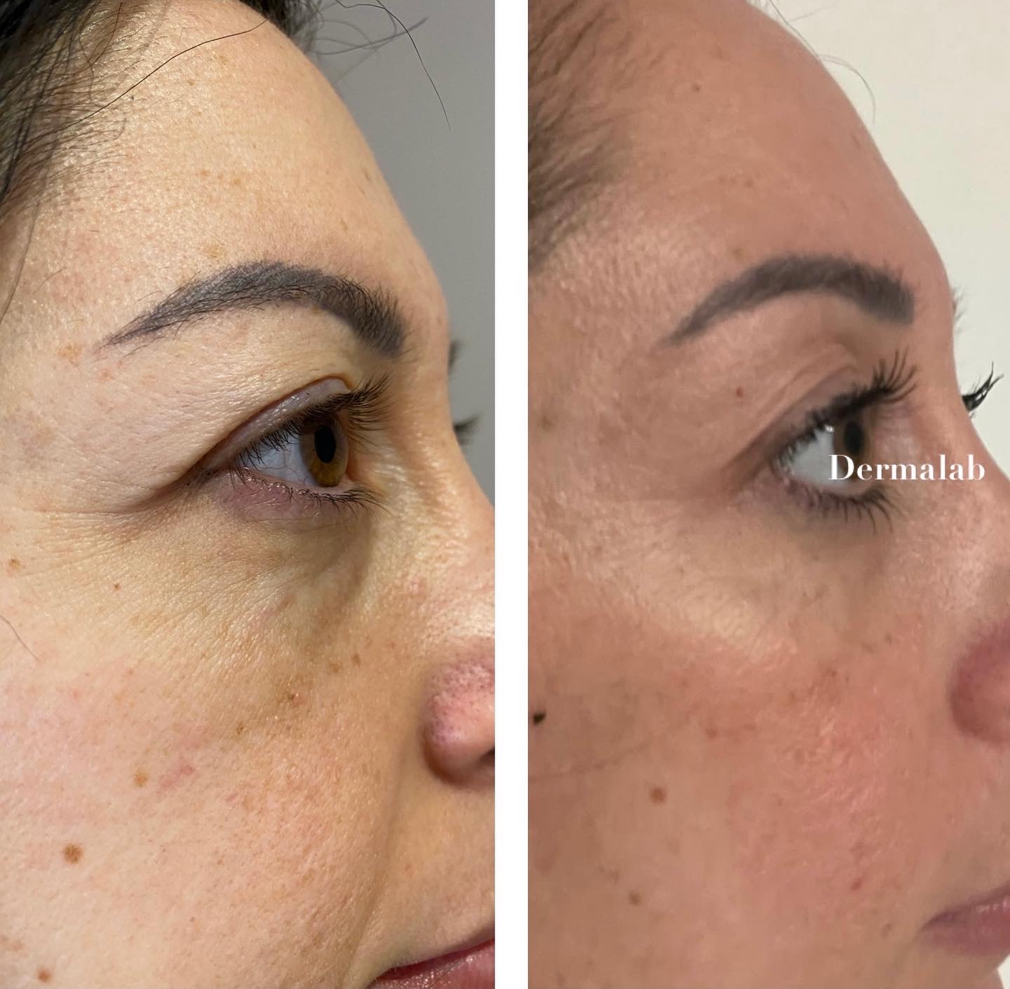 Images Dermalab