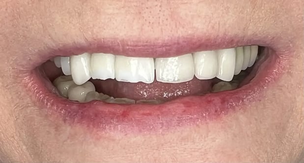 Images Nicole E. Kuske, DDS
