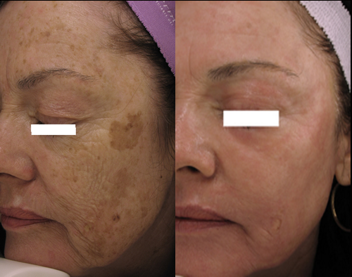 Images Perfect Skin Center
