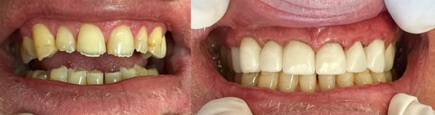 Images Morgan Dental