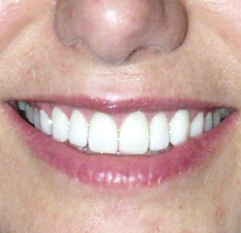 Images Southern York Smile Care