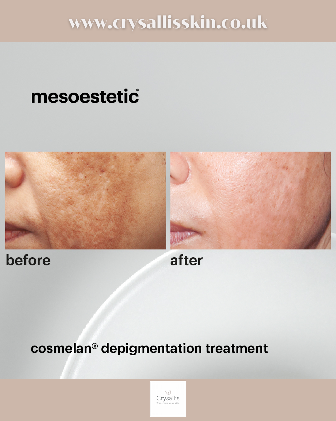 Images Crysallis Skin Clinic