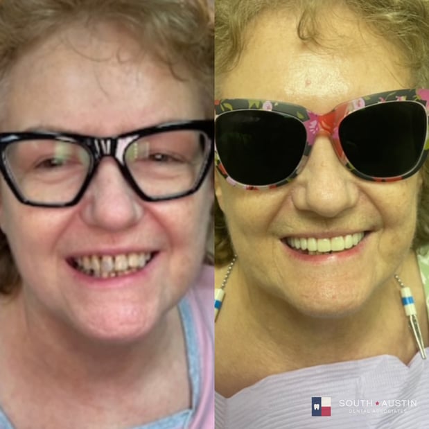 Images South Austin Dental Associates