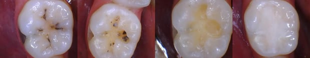 Images LaFayette Dental Associates