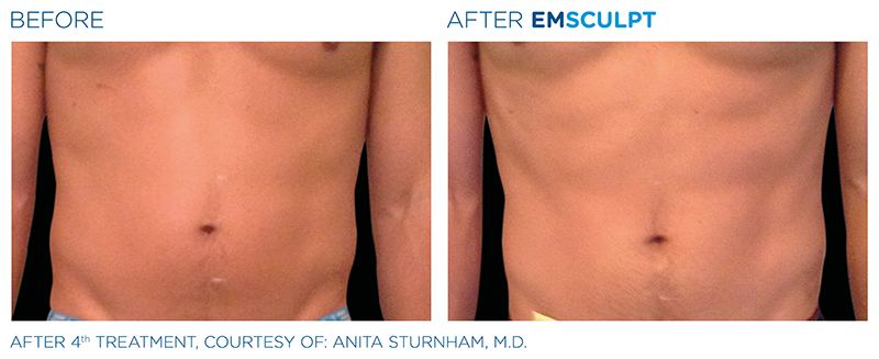 Slim Studio EMSCULPT & Coolsculpting Photo