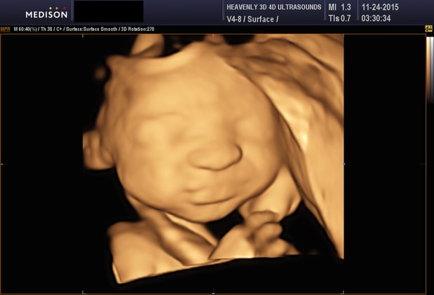 Images Heavenly 3D 4D Ultrasounds-Upland