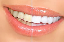 Images Norwich Family & Cosmetic Dentistry