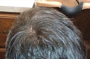 Images Hair Associates Customized Hair Systems