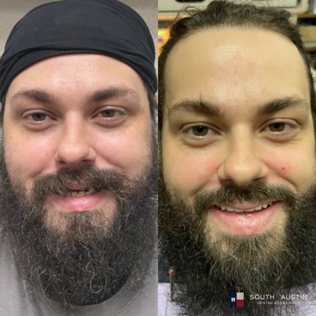 Images South Austin Dental Associates