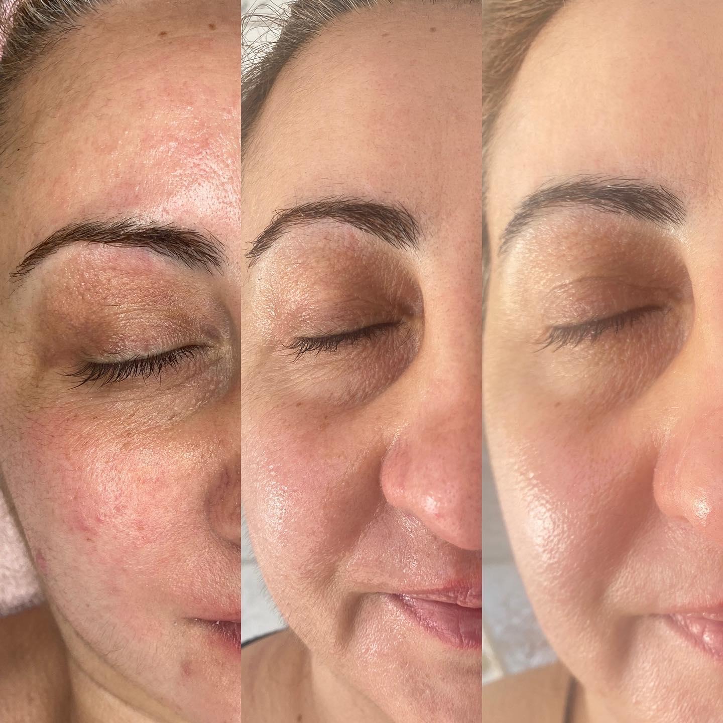 Images Luminous Skin