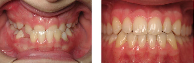 Images Wirtz Orthodontics