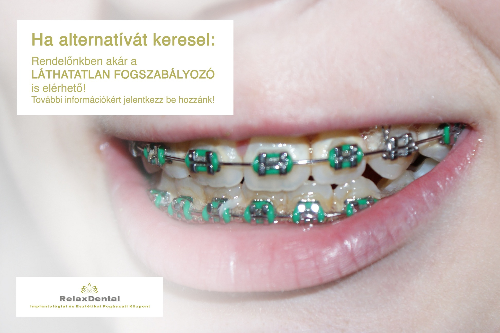 Images Relax Dental Implantológiai és Esztétikai Fogászati Központ