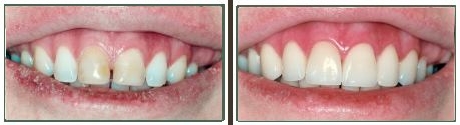 Images Tierrasanta Plaza Dental