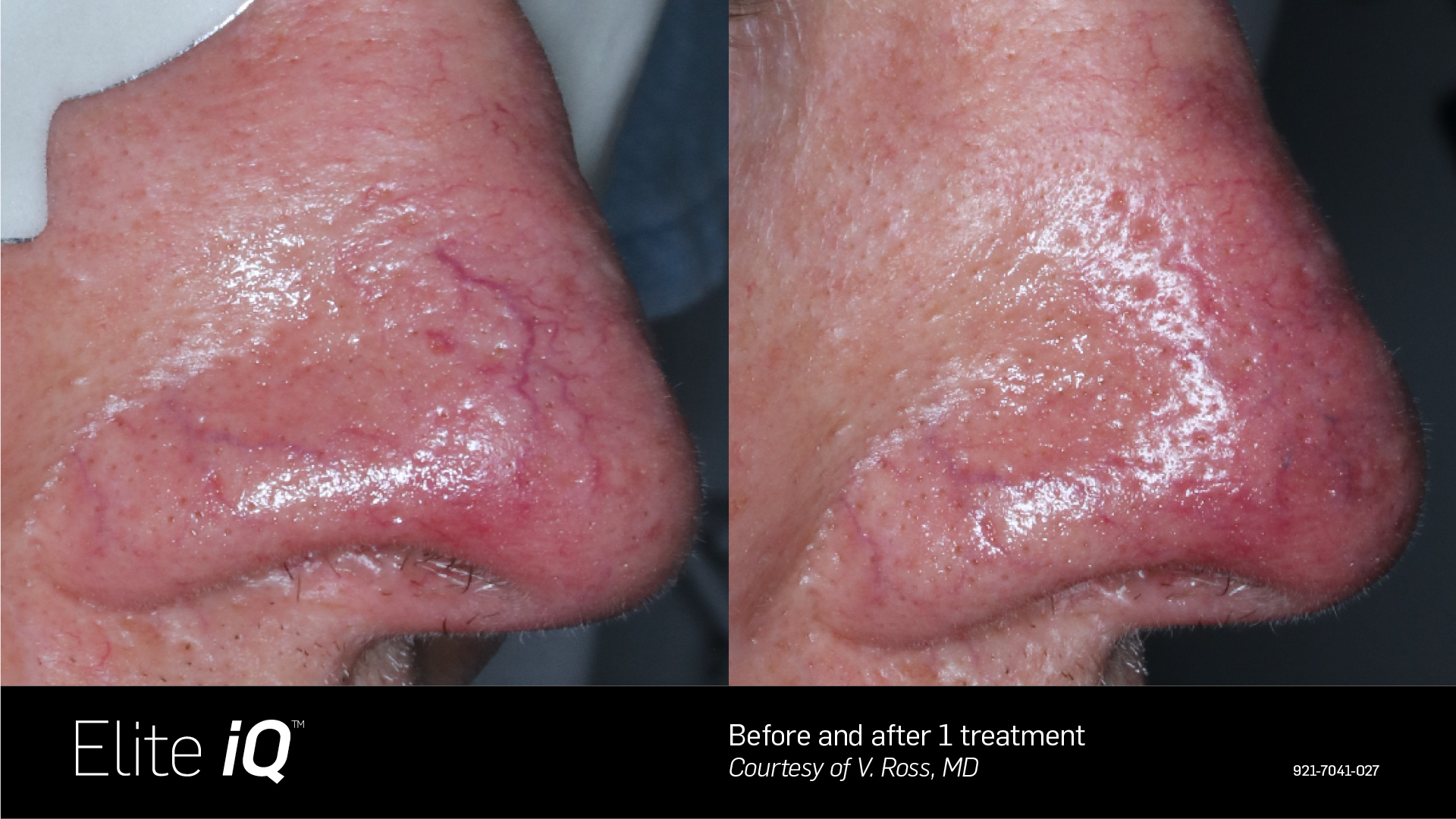 Images Onyx Esthétique - Soins esthétiques, Soins de la peau, Laser Cynosure Gatineau