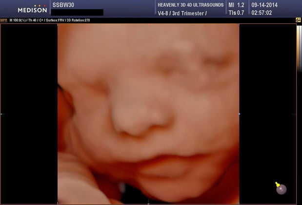 Images Heavenly 3D 4D Ultrasounds-Upland