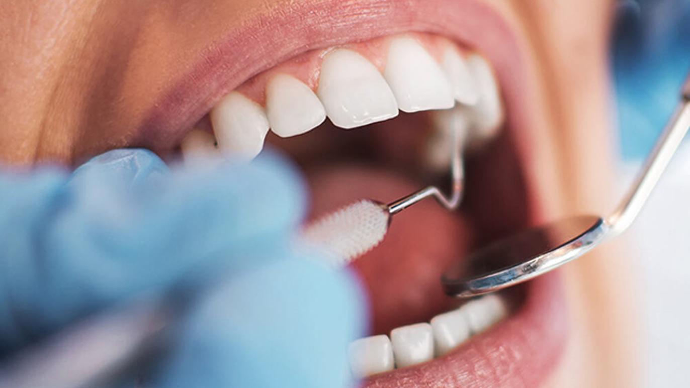 Images Tandlæge Michael Secher