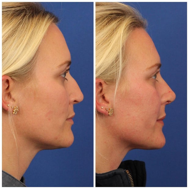 Images Dr. Sumit Bapna, MD