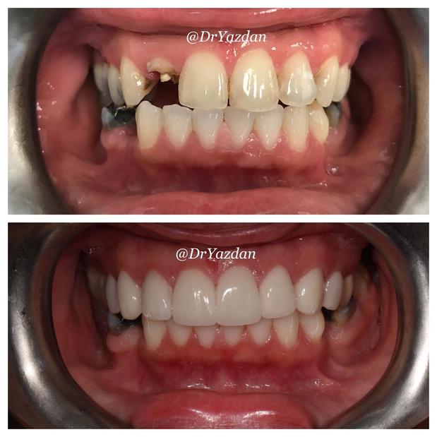 Images Dr. Desiree Yazdan - Center For Restorative & Cosmetic Dentistry