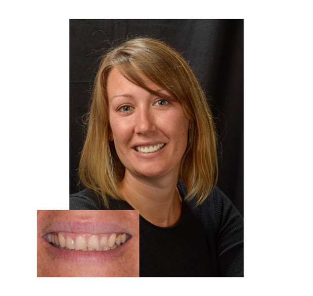 Images San Diego Smiles