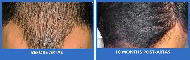 Austin Hair Restoration Clinic Photo