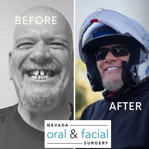 Images Nevada Oral & Facial Surgery - Henderson, NV