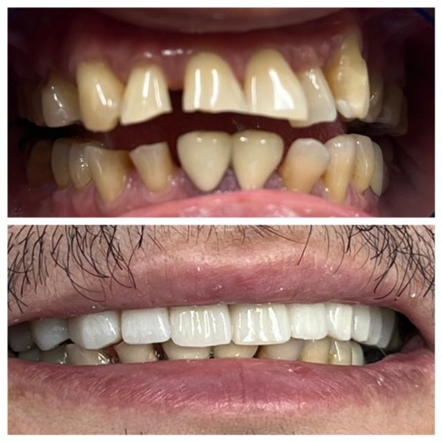 Images Best Dental - Family & Orthodontics