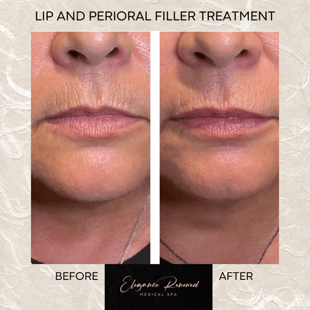 Images Elegance Renewed Medical Spa