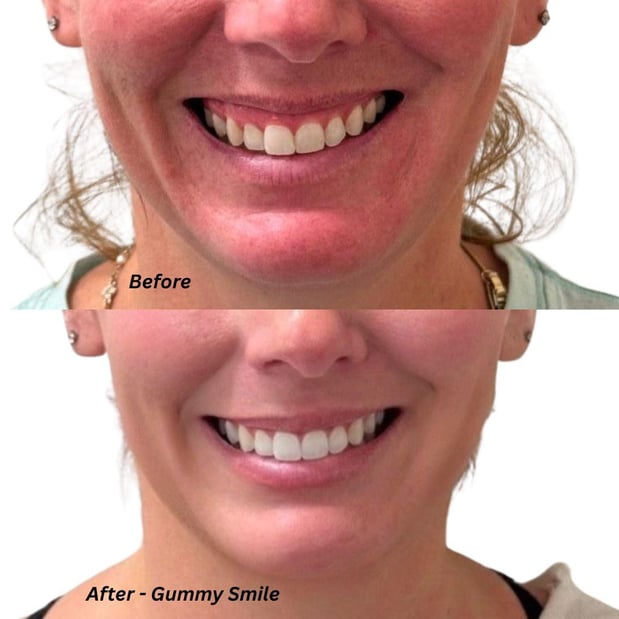 Images Injections and Co.