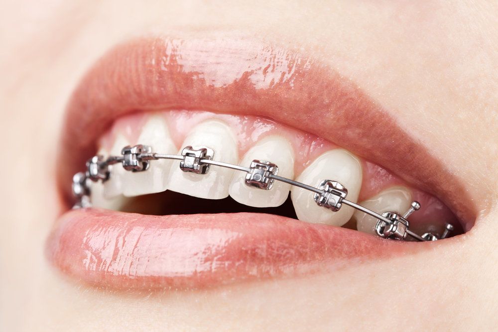 Hulme Orthodontics Photo