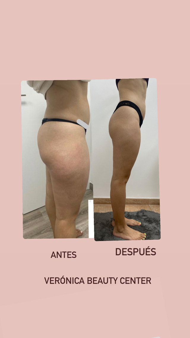 Images Verónica Beauty Center