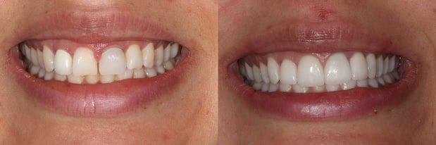 Images Blue Sage Dental