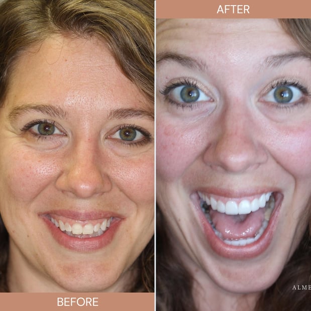 Images Almeida & Bell Dental Lone Tree - General, Cosmetic, and Implant Dentistry