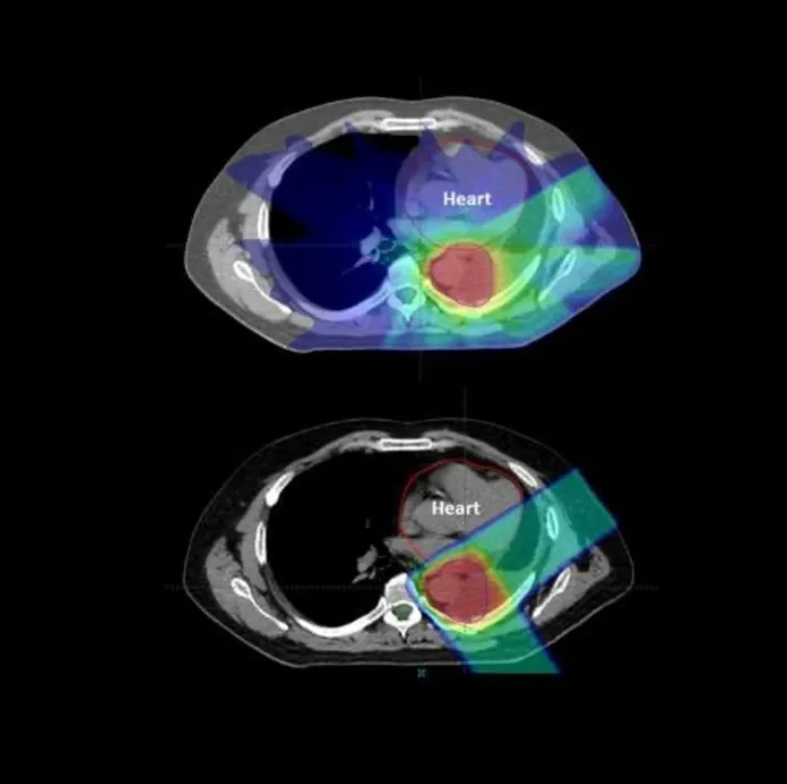 Images Dr James Wilson - Oncologist London