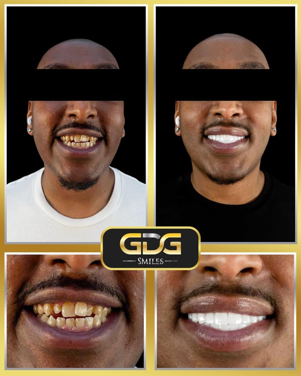 Images GDG Smiles