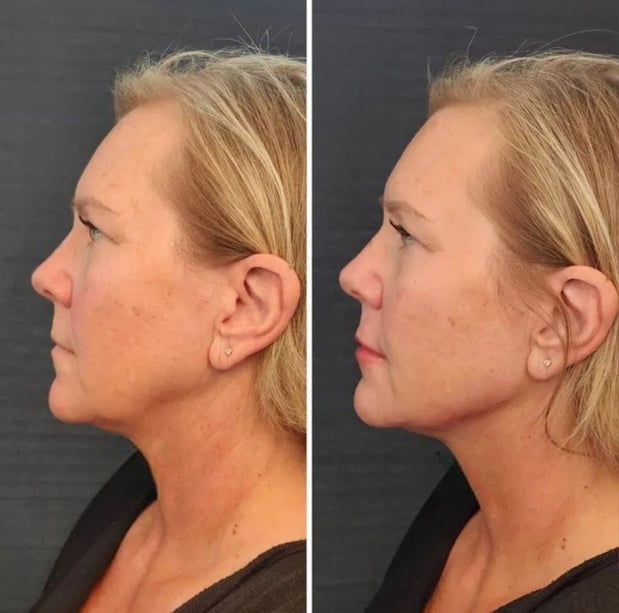 Images Che Bella Injectables And Aesthetics