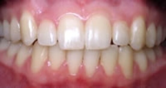 Kieferorthopädie - Dres. Czell Geretsried, Karl-Lederer-Platz 9 in Geretsried