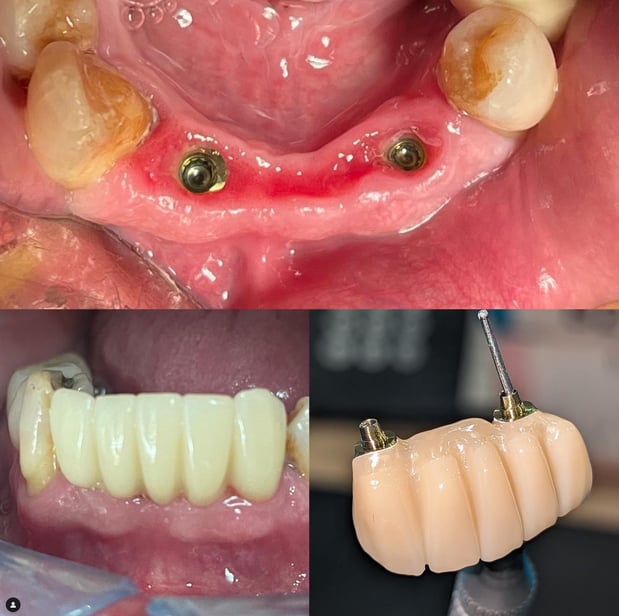 Images Queensboro Oral Surgery & Associates