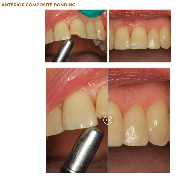 Images David A. Rice, DDS