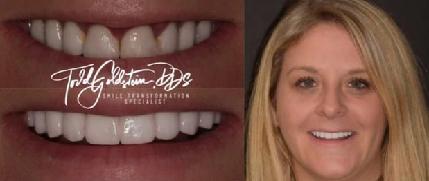 Images Todd Goldstein DDS