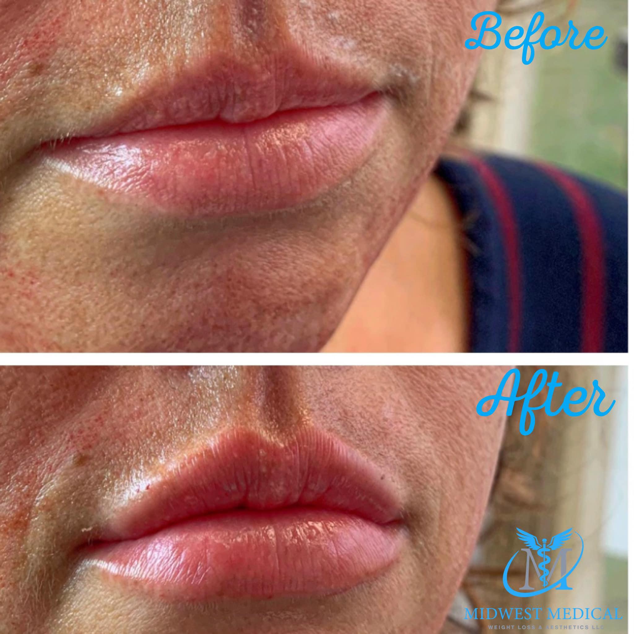 Midwest Medical, Weight Loss & Aesthetics